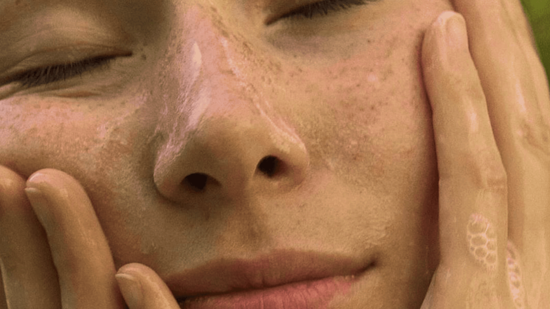 Close-up of a person's face with closed eyes and hands resting on cheeks, showing freckles and light skin texture.